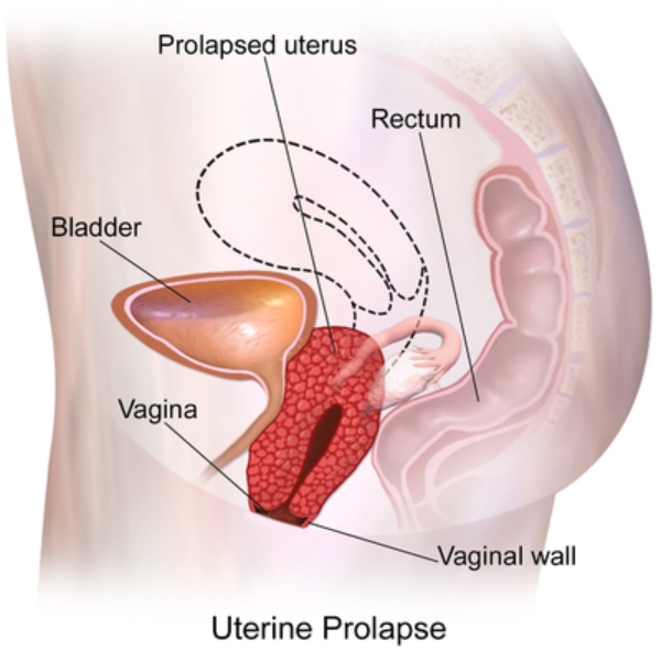 best infertility hospital near me in Nacharam